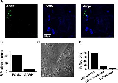 TRPC1/5-CaV3 Complex Mediates Leptin-Induced Excitability in Hypothalamic Neurons